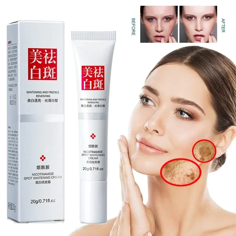 تتلاشى وتحسين النمش البقع السو - مراجعة Skincare Glow وسعره