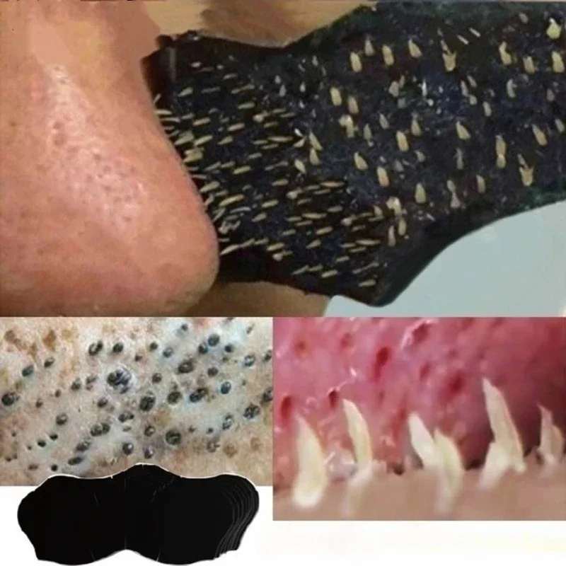 10 قطع/50 قطعة 100 قطعة رقعة أ - مراجعة Skincare Viral Tiktok وسعره