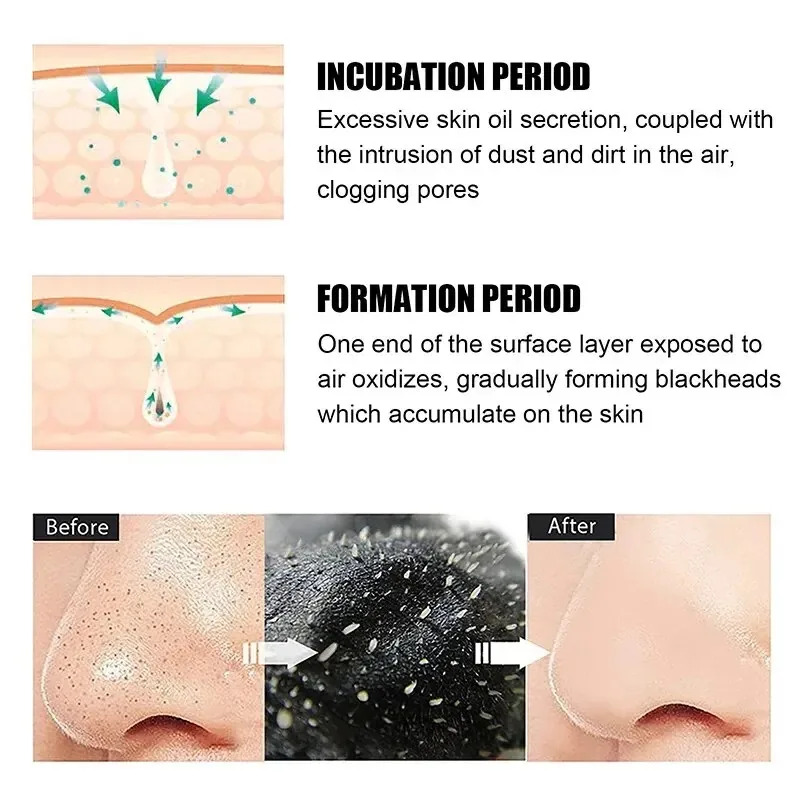10/150 قطعة شرائط أنفية لإزالة - مراجعة Skincare Viral Tiktok وسعره